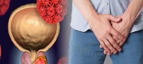 Enlarged Prostate Treatment in Rohini